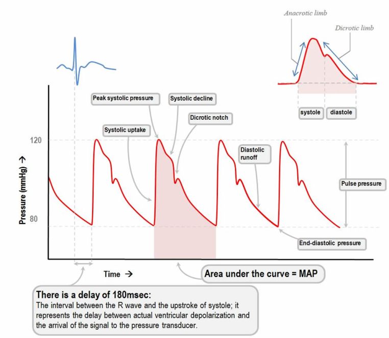 arterial pressure waveform